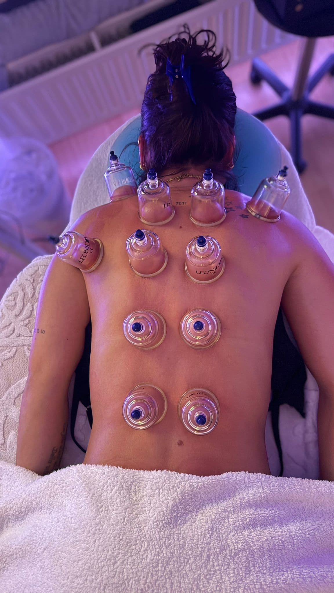 Cuppingmassage